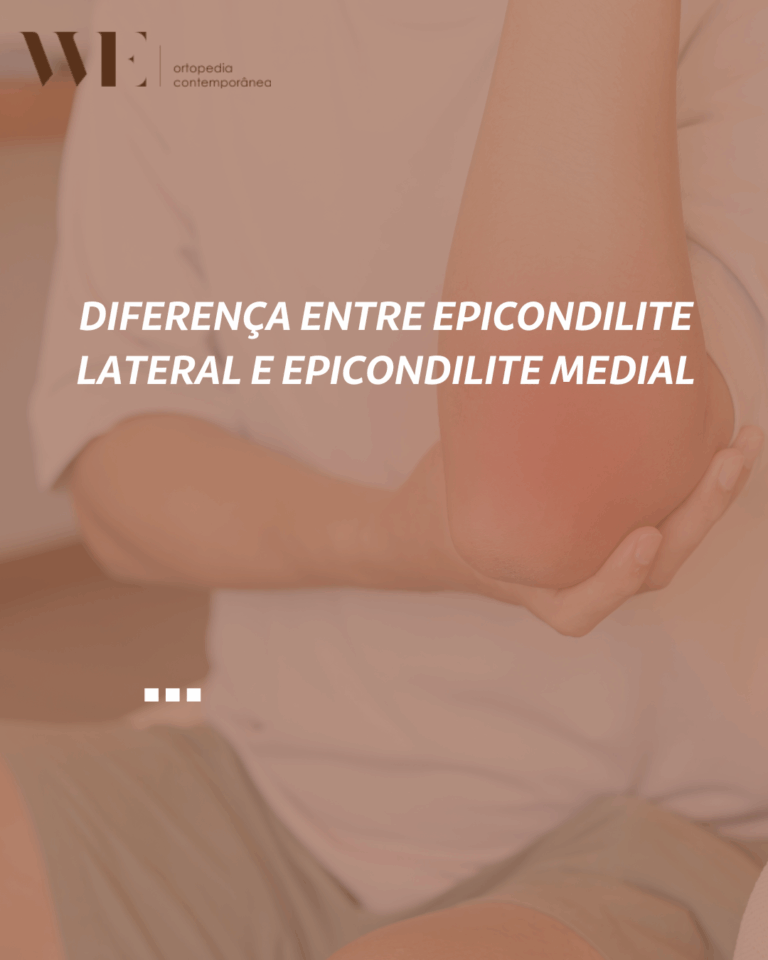 Diferença entre Epicondilite Lateral e Epicondilite Medial – We